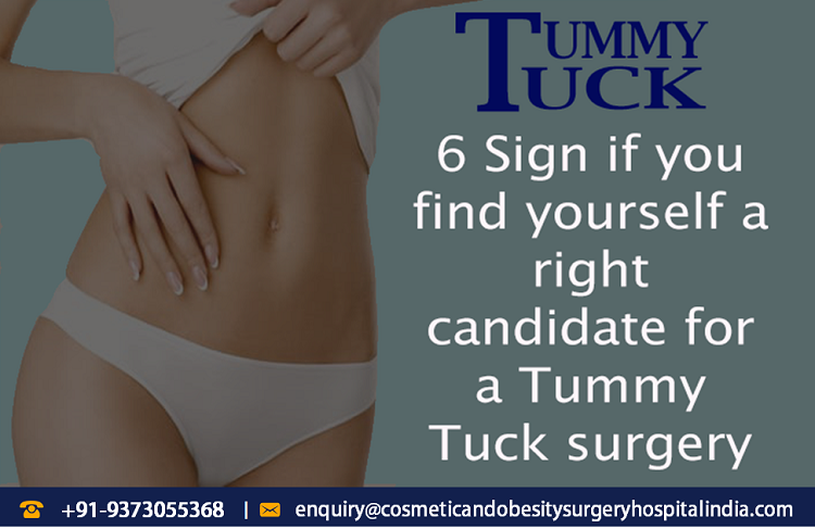 6 Sign if you find yourself a right candidate for a Tummy Tuck surgery